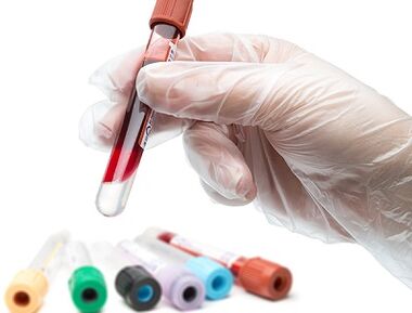 Análisis de sangre para parásitos