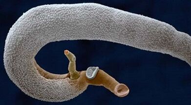 ¿Qué parásitos pueden vivir en el estómago humano