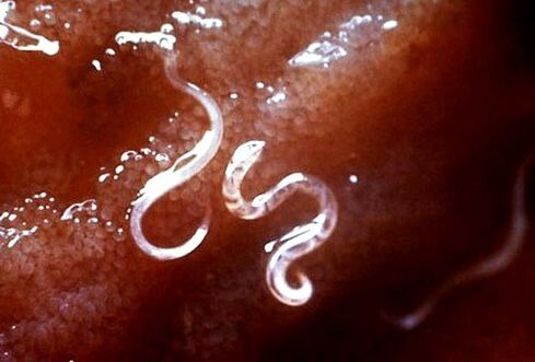 parásitos dentro del cuerpo