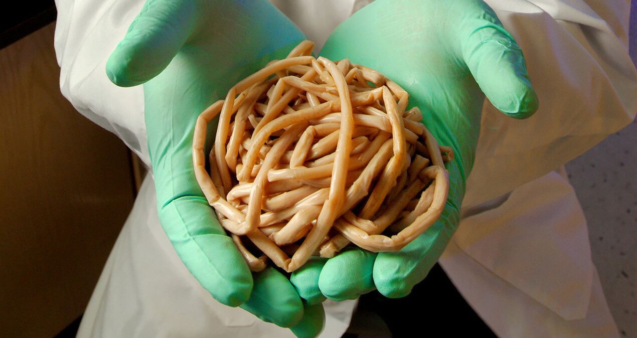 Gusanos (helmintos) en manos de un médico.