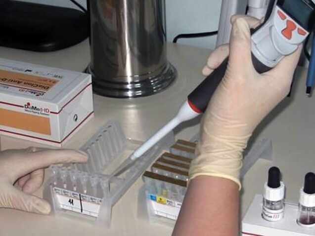 Pruebas de laboratorio para diagnosticar enfermedades parasitarias.